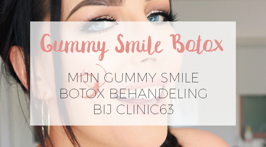 GUMMY SMILE BOTOX BIJ CLINIC63